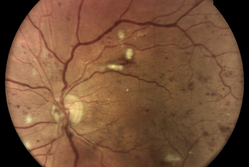 Produkty / Ako funguje ICAER ILLUME - foto Produkty / Ako funguje ICAER ILLUME - foto