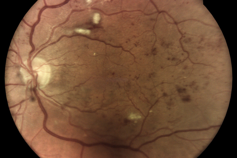 Produkty / Ako funguje ICAER ILLUME - foto Produkty / Ako funguje ICAER ILLUME - foto