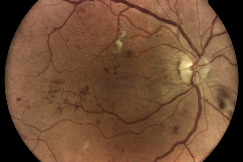 Produkty / Ako funguje ICAER ILLUME - foto Produkty / Ako funguje ICAER ILLUME - foto