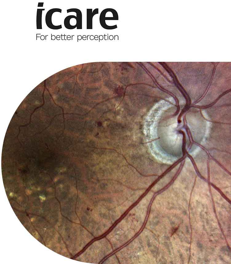 Hlavné výhody našej technológie pre pacienta