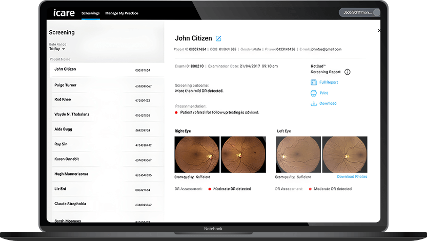 Software iCare RETCAD®